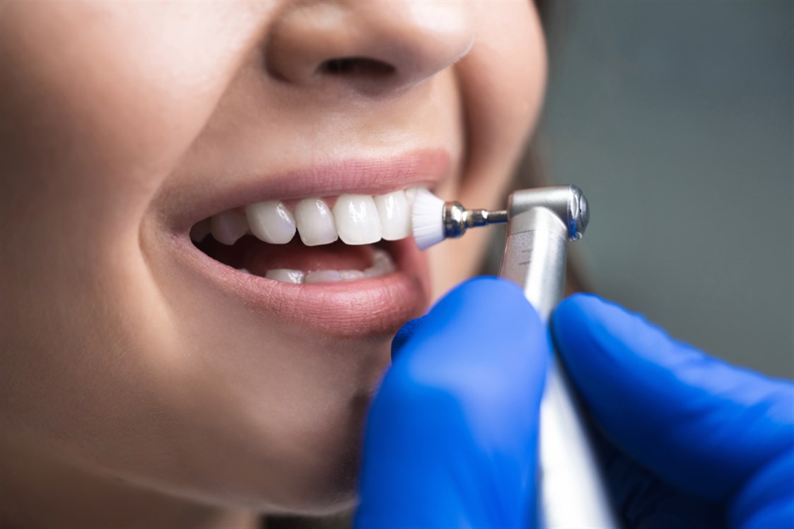 ما علاقة نظافة الأسنان بمرضى السكري؟ - المــــنـــظــــور